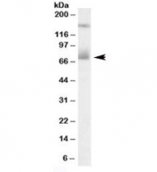 Western blot testing of human placenta lysate with Mesothelin antibody at 0.3ug/ml. The expected ~70kDa band and the additional ~150kDa band are both blocked by the immunizing peptide.