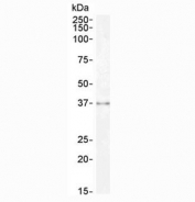 Western blot testing of human kidney lysate with Sprouty antibody at 0.3ug/ml. Predicted molecular weight ~35 kDa.