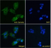 IF/ICC testing of fixed and permeabilized human HepG2 cells with Sprouty antibody (green) at 10ug/ml and DAPI nuclear stain (blue).