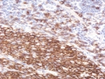 IHC staining of FFPE human tonsil with CD20 antibody at 2ug/ml. HIER: steamed with pH6 citrate buffer, HRP-staining.