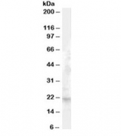 Western blot testing of human liver lysate with FGF21 antibody at 1ug/ml. Predicted molecular weight ~21kDa.