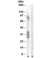 Western blot testing of human prostate lysate with ADAM33 antibody at 0.3ug/ml with [B] and without [A] immunizing peptide. Predicted molecular weight: ~88kDa but bands from 22-38kDa may also be visualized.