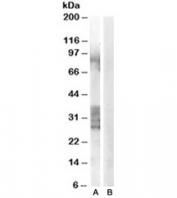 Western blot testing of human prostate lysate with ADAM33 antibody at 0.3ug/ml with [B] and without [A] immunizing peptide. Predicted molecular weight: ~88kDa but bands from 22-38kDa may also be visualized.