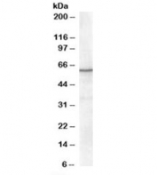 Western blot testing of nuclear HeLa lysate with RXR alpha antibody at 0.3ug/ml. Predicted molecular weight: ~51kDa but routinely observed at 54~60kDa.
