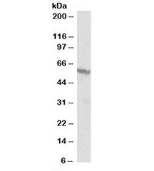 Western blot testing of A431 lysate and RXR beta antibody at 1ug/ml. Predicted molecular weight: ~57kDa but routinely observed at 57~60kDa.~
