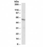 Western blot testing of A431 lysate and RXR beta antibody at 1ug/ml. Predicted molecular weight: ~57kDa but routinely observed at 57~60kDa.