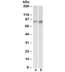 Westernb lot of mouse (A) and rat (B) brain lysates with NPAS4 antibody at 1ug/ml. Predicted molecular weight ~87k