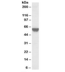 Western blot testing of A431 lysate with TOM1L2 antibody at 0.03ug/ml. Predicted molecular weight: ~50/56kDa (isoforms 1/3).~