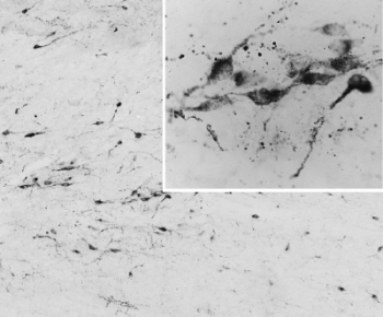 IHC testing of PFA-perfused cryosection of human hypothalamus and AGRP antibody at 0.05ug/ml. HIER: pH6 citrate buffer at 80C for 30min, HRP-staining with Ni-DAB after biotin-SP-anti-goat amplification.
