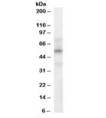 Western blot testing of human spleen lysate with LXRA/B antibody at 1ug/ml. Predicted molecular weight: ~50kDa.