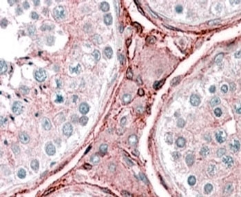 IHC testing of FFPE human testis with CYBRD1 antibody at 2.5ug/ml. HIER: steamed with pH6 citrate buffer, AP-staining.~