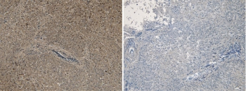 IHC staining of FFPE human liver tissue with (left) and without (right) PCSK9 antibody at 5ug/ml. Required HIER: steamed antigen