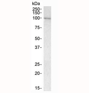 Western blot testing of human bone marrow lysate with VAV3 antibody at 1ug/ml. Predicted molecular weight: ~97 kDa (isoform alpha), 87 kDa (isoform beta).