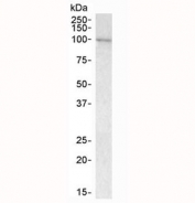 Western blot testing of human bone marrow lysate with VAV3 antibody at 1ug/ml. Predicted molecular weight: ~97 kDa (isoform alpha), ~87 kDa (isoform beta).