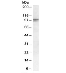 Western blot testing of human pancreas lysate with TAS1R2 antibody at 0.3ug/ml. Predicted molecular weight: ~95kDa.