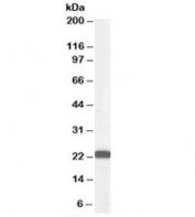 Western blot testing of HeLa lysate with BAG2 antibody at 0.3ug/ml. Predicted molecular weight: ~22kDa.
