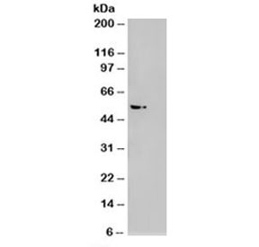 Western blot of HEK293 lysate overexpressing AKT3 probed with AKT3 antibody (mock transfection on right). Predicted molecular weight: ~56kDa but can be observed from 60~65kDa.
