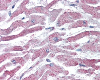 IHC testing of FFPE human heart tissue with AKT3 antibody at 5ug/ml. Required HIER: steamed antigen retrieval with pH6 citrate buffer; AP-staining.