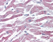 IHC testing of FFPE human heart tissue with AKT3 antibody at 5ug/ml. Required HIER: steamed antigen retrieval with pH6 citrate buffer; AP-staining.