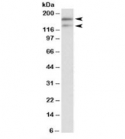 Western blot testing of human testis lysate with DUOX1 antibody at 0.1ug/ml. Predicted molecular weight: ~177/140kDa (isoforms 1/2). Both observed bands are blocked by addition of immunizingn peptide.
