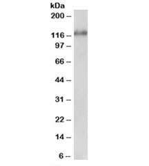 Western blot testing of Jurkat lysate with USP11 antibody at 1ug/ml. Predicted molecular weight: ~110kDa, routinely observed at ~120kDa. (1)