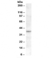 Western blot testing of Jurkat cell lysate with RASSF7 antibody at 1ug/ml. Predicted molecular weight: ~40kDa.