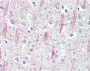 IHC testing of FFPE human brain (cortex) tissue with GPR125 antibody at 3.75ug/ml. Required HIER: steamed antigen retrieval with pH6 citrate buffer; AP-staining.