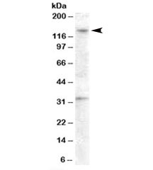 Western blot testing of human ovay lysate with GPR125 antibody at 0.5ug/ml. The expected ~140kDa band and the additional ~33kDa band are both blocked by the immunizing peptide.~