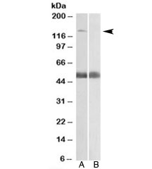 Western blot testing of human prostate lysate with COPA antibody at 0.5ug/ml with [B] and without [A] blocking/immunizing peptide. Predicted molecular weight: ~138kDa.