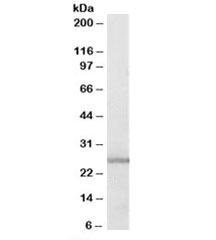 Western blot testing of human lung lysate with GSTM1 antibody at 0.3ug/ml. Predicted molecular weight: ~26kDa.