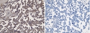 IHC testing of FFPE human placenta tissue with (left) and without (right) IDO antibody at 6ug/ml. HIER: steamed with pH6 citrate buffer.