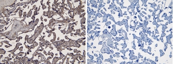 IHC testing of FFPE human placenta tissue with (left) and without (right) IDO antibody