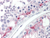 IHC testing of FFPE human testis tissue with ZDHHC17 antibody at 5ug/ml. Required HIER: steamed antigen retrieval with pH6 citrate buffer; AP-staining.