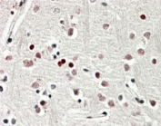 IHC staining of FFPE human cerebral cortex with SOX3 antibody at 4ug/ml. HIER: steamed with pH6 citrate buffer, AP-staining.