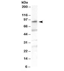 Western blot testing of human duodenum lysate with OSBPL10 antibody at 1ug/ml. Predicted molecular weight: ~84kDa.