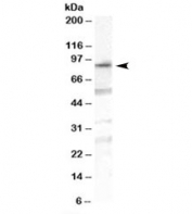 Western blot testing of human duodenum lysate with OSBPL10 antibody at 1ug/ml. Predicted molecular weight: ~84kDa.