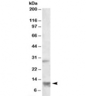 Western blot testing of human heart lysate with RNF7 antibody at 1ug/ml. Predicted molecular weight: ~13kDa.