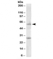 Western blot testing of Daudi lysate with SOCS7 antibody at 1ug/ml. The expected ~60kDa band and the additional ~28kDa band are both blocked by the immunizing peptide.