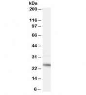 Western blot testing of human heart lysate with Neurturin antibody at 0.1ug/ml. Predicted molecular weight: ~22kDa.