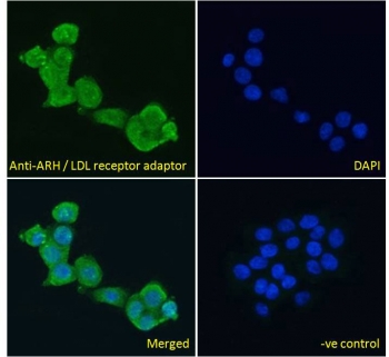 IF/ICC testing of fixed and permeabilized human A431 cells with ARH antibody (green) at 10ug/ml and DAPI nuclear stain (blue).~