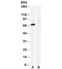 Western blot testing of human heart lysate with Monoamine Oxidase A antibody at 0.3ug/ml with [B] and without [A] the immunizing peptide. Predicted molecular weight: ~60kDa, observed here at ~70kDa.~