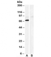 Western blot testing of human heart lysate with Monoamine Oxidase A antibody at 0.3ug/ml with [B] and without [A] the immunizing peptide. Predicted molecular weight: ~60kDa, observed here at ~70kDa.