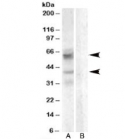 Western blot testing of A459 lysate with Arylsulfatase D antibody with [B] and without [A] blocking/immunizing peptide. Predicted molecular weight: ~65/42kDa (isoforms alpha/beta).