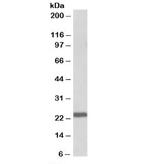 Western blot testing of human bone marrow lysate with IL15 antibody at 1ug/ml. Predicted molecular weight: ~18/23kDa (unmodified/glycosylated).