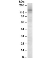 Western blot testing of Daudi cell lysate with AS160 antibody at 0.1ug/ml. Predicted molecular weight ~147 kDa but routinely observed at 147-160 kDa.~