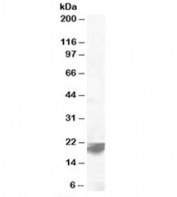 Western blot testing of human spleen lysate with VPS29 antibody at 0.1ug/ml. Predicted molecular weight: ~20/21kDa (isoforms 1/2).
