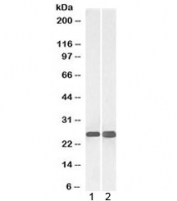 Western blot testing of 1) human cerebellum and 2) mouse brain lysate with SNAP25 antibody at 0.03ug/ml. Expected molecular weight: ~25 kDa.