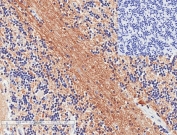 IHC staining of FFPE human cerebellum tissue with (left) and without (right) SNAP25 antibody at 1ug/ml. HIER: steamed with pH6 citrate buffer, HRP-staining.