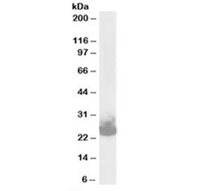 Western blot testing of mouse brain lysate with SNAP25 antibody at 0.03ug/ml. Expected molecular weight: ~25kDa.