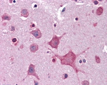 IHC testing of FFPE human cortex (brain) tissue with DPP10 antibody at 3.75ug/ml. Required HIER: steamed antigen retrieval with pH6 citrate buffer; AP-staining.